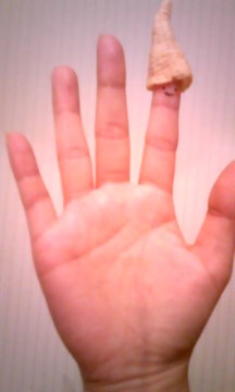 とんがり…の画像2